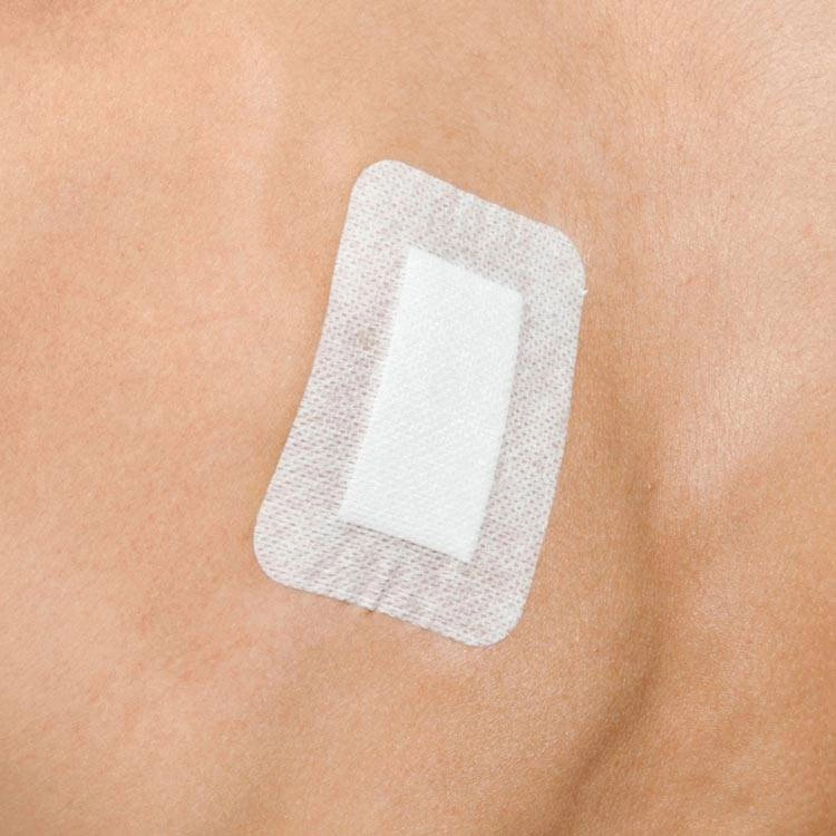 Steropore Adhesive Wound Dressings